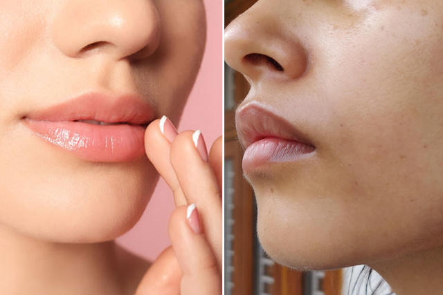 7 وصفات مجربة لإزالة السواد حول الفم في يوم
