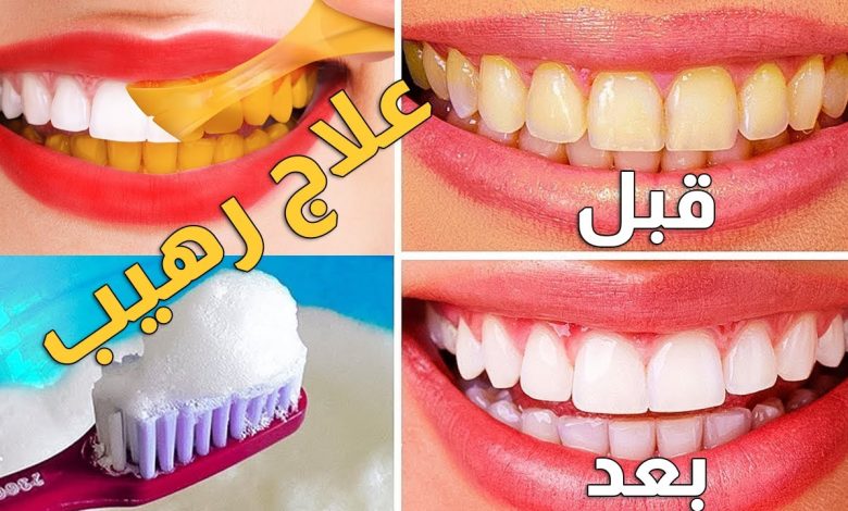 وصفة لتبييض الأسنان وإزالة الرائحة من الفم