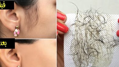 وصفة طبيعية لإزالة شعر الوجه بدون ألم