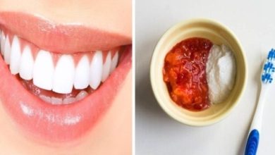 الحصول على أسنان ناصعة البياض بوقت قصير بمزج هذين المكونين